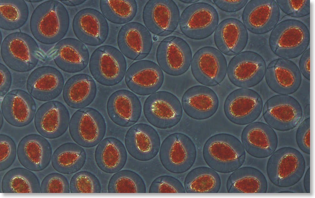 Haematococcus 400x Zeiss cdf 02